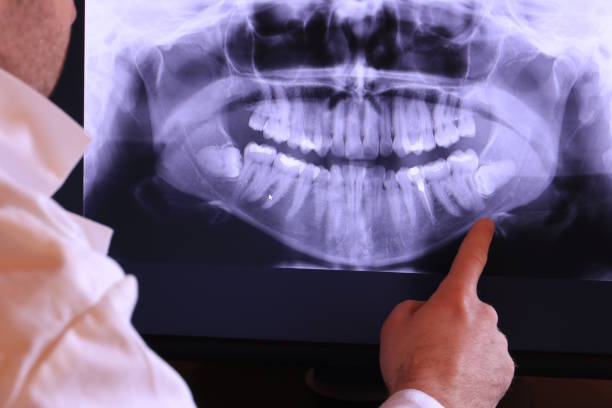 Best Emergency Denture Repair in Franklin Park, NJ